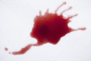 1da71b8892bf5187628804a454b07e28