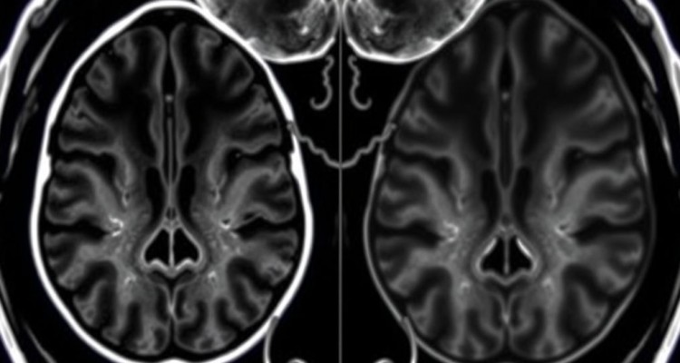 Цель МРТ спинного мозга